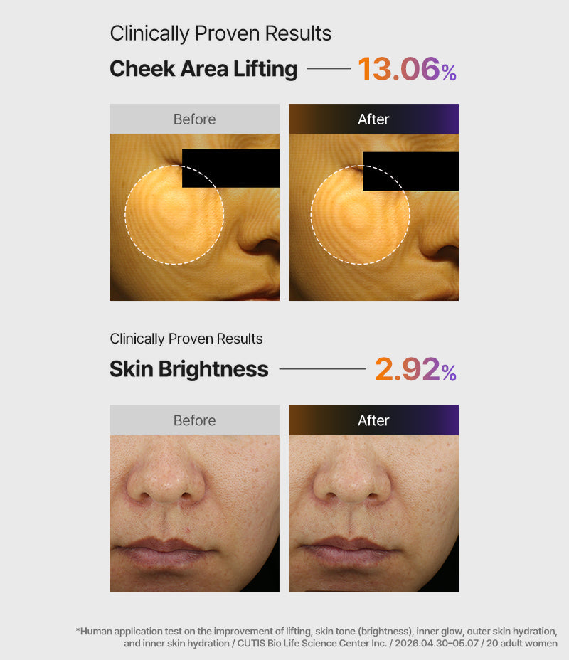 Before and after photo pairs for cheek area lifting appearance and skin brightness, with test footnote / 面頰緊緻外觀同膚色亮度嘅使用前後對比相，附測試說明