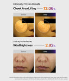 Before and after photo pairs for cheek area lifting appearance and skin brightness, with test footnote