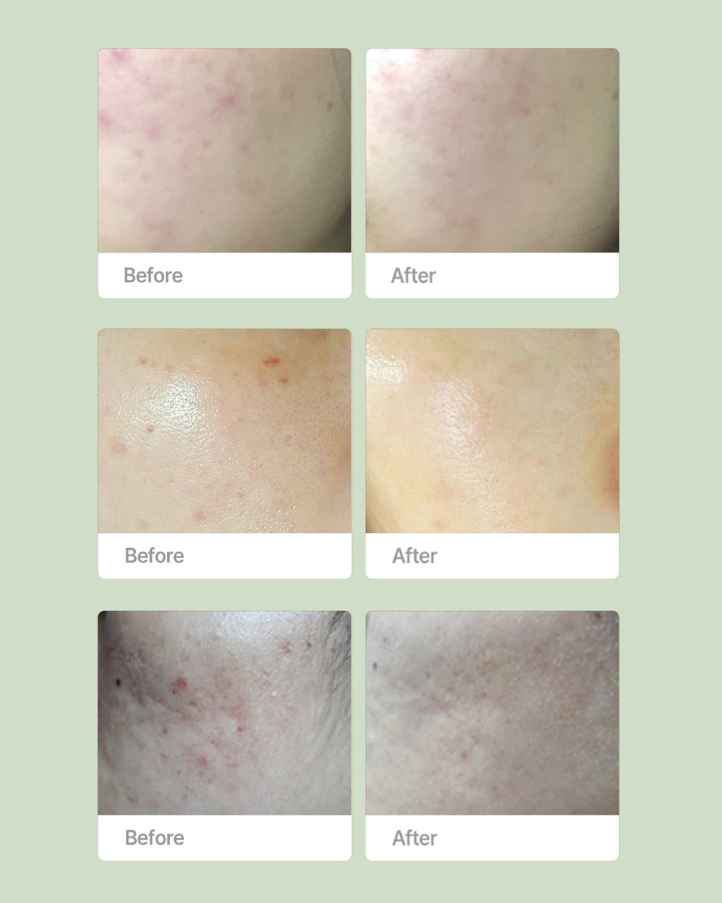 Purifying Kit serum and cream bottles side by side / Purifying Kit 精華同面霜並排