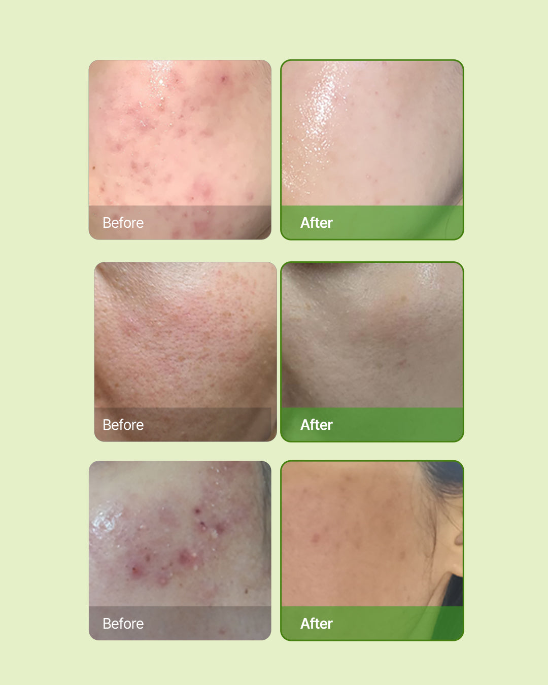 Skin Barrier Ato Cream texture swatch close-up / Skin Barrier Ato Cream 質地特寫