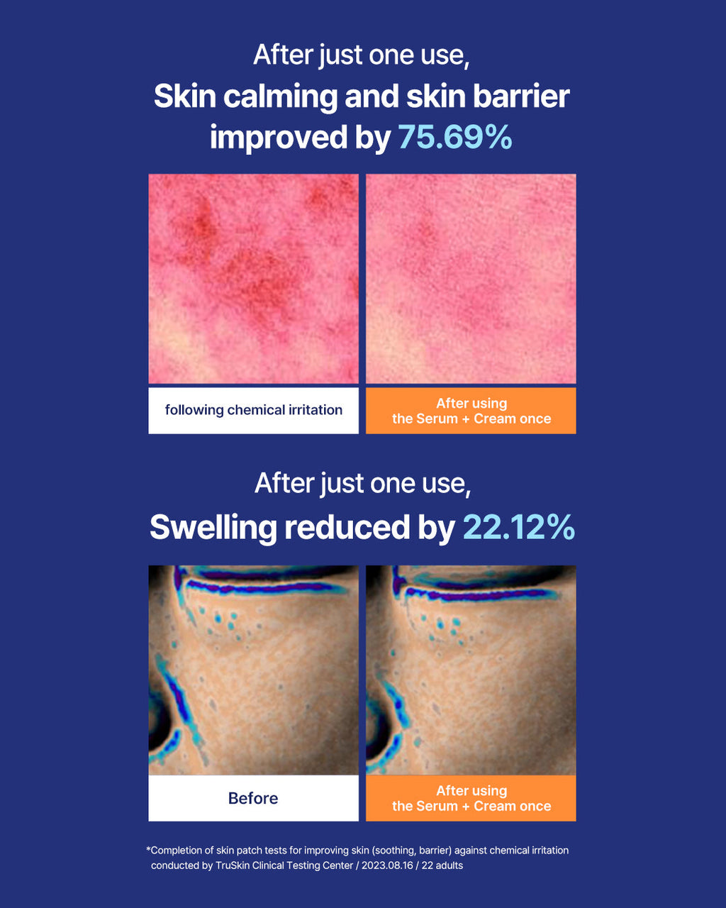 Sukalming serum and cream bottles side by side / Sukalming 精華同面霜並排