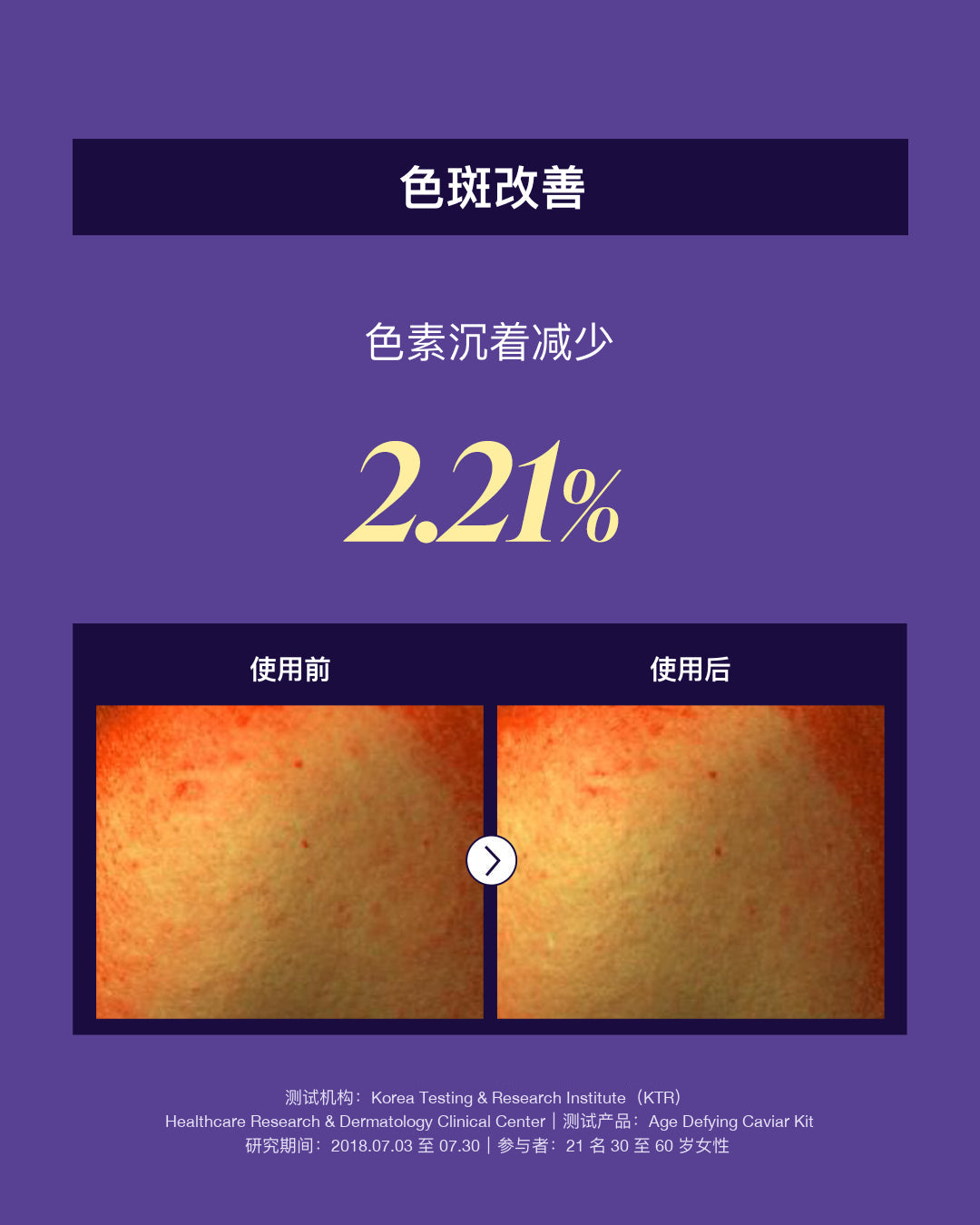 Age Defying Caviar Kit 面霜质地特写