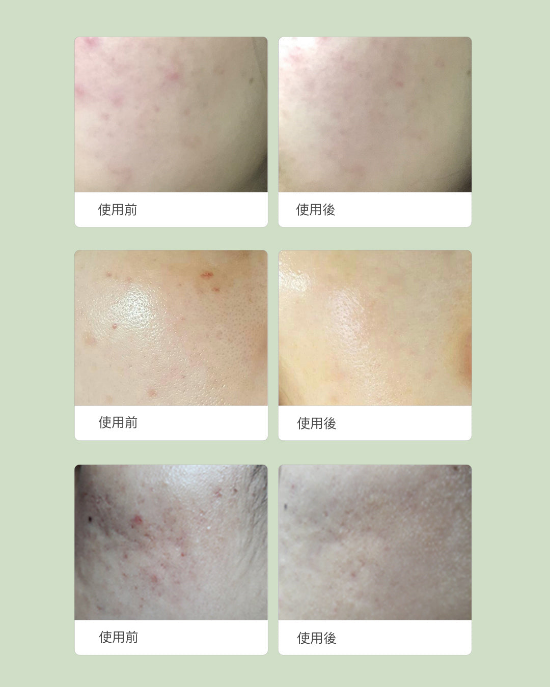 Purifying Kit 精華同面霜並排