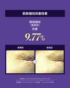 肌肤皱纹改善效果：眼周细纹（鱼尾纹）改善 9.77%，使用前后对比；受测产品 Age Defying Caviar Kit