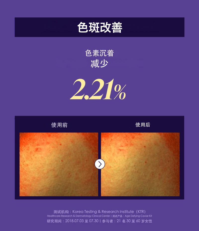 Age Defying Caviar Cream 抗衰老系列情境图